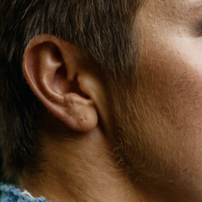Orta kulak iltihabı vertigoya sebep olur mu?